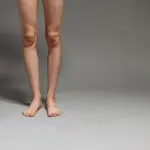 Ginocchio valgo: cause, effetti e correzione